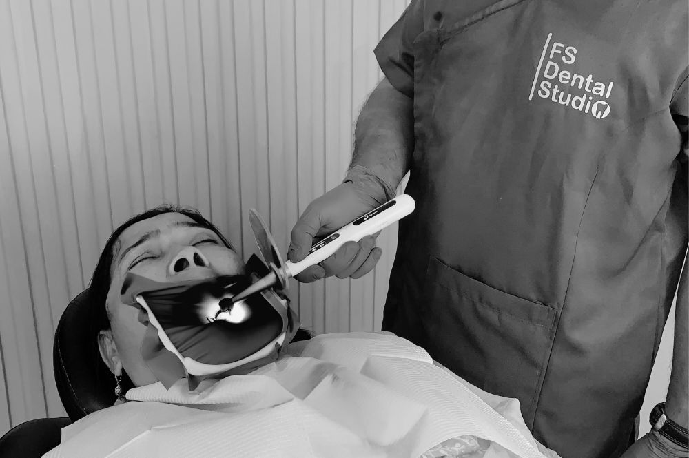 Restoration (Filling)